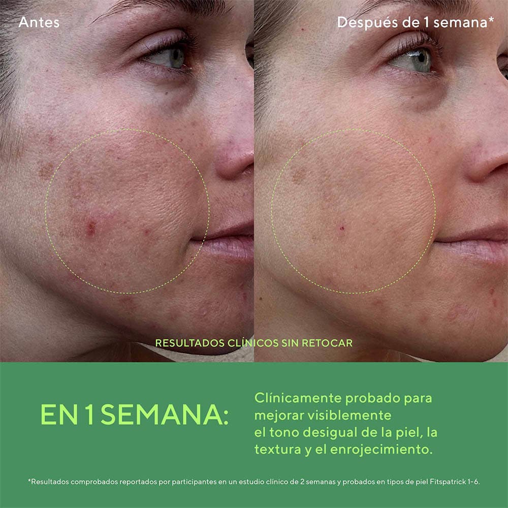 BIOME BALANCING CALM + RECOVER CREAM POST-ACN&Eacute; (CREMA FACIAL CALMANTE REPARADORA)